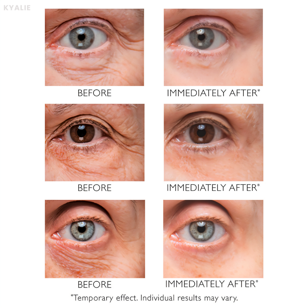 KYALIE | Instant Wrinkle Corrector