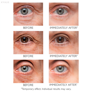 KYALIE | Instant Wrinkle Corrector