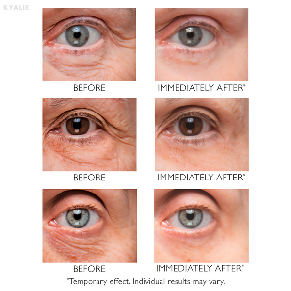 KYALIE | Instant Wrinkle Corrector